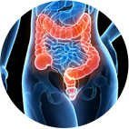 Colon Cancer