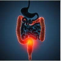 Colon Cancer Treatment Cost in India