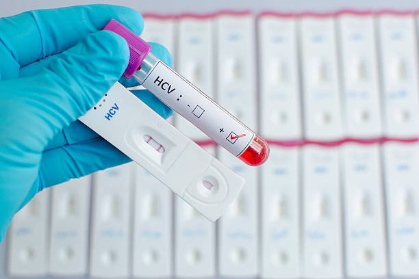 HCV Test Price in India