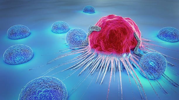 Symptoms of Bone Cancer
