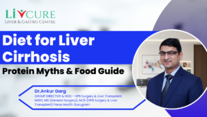 Diet for Liver Cirrhosis: Protein Myths & Food Guide